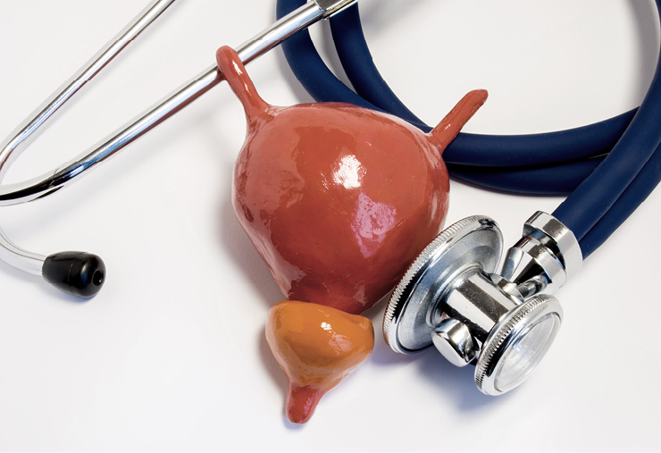 Hoy se conmemora el Día Mundial del Cáncer de Próstata prevención