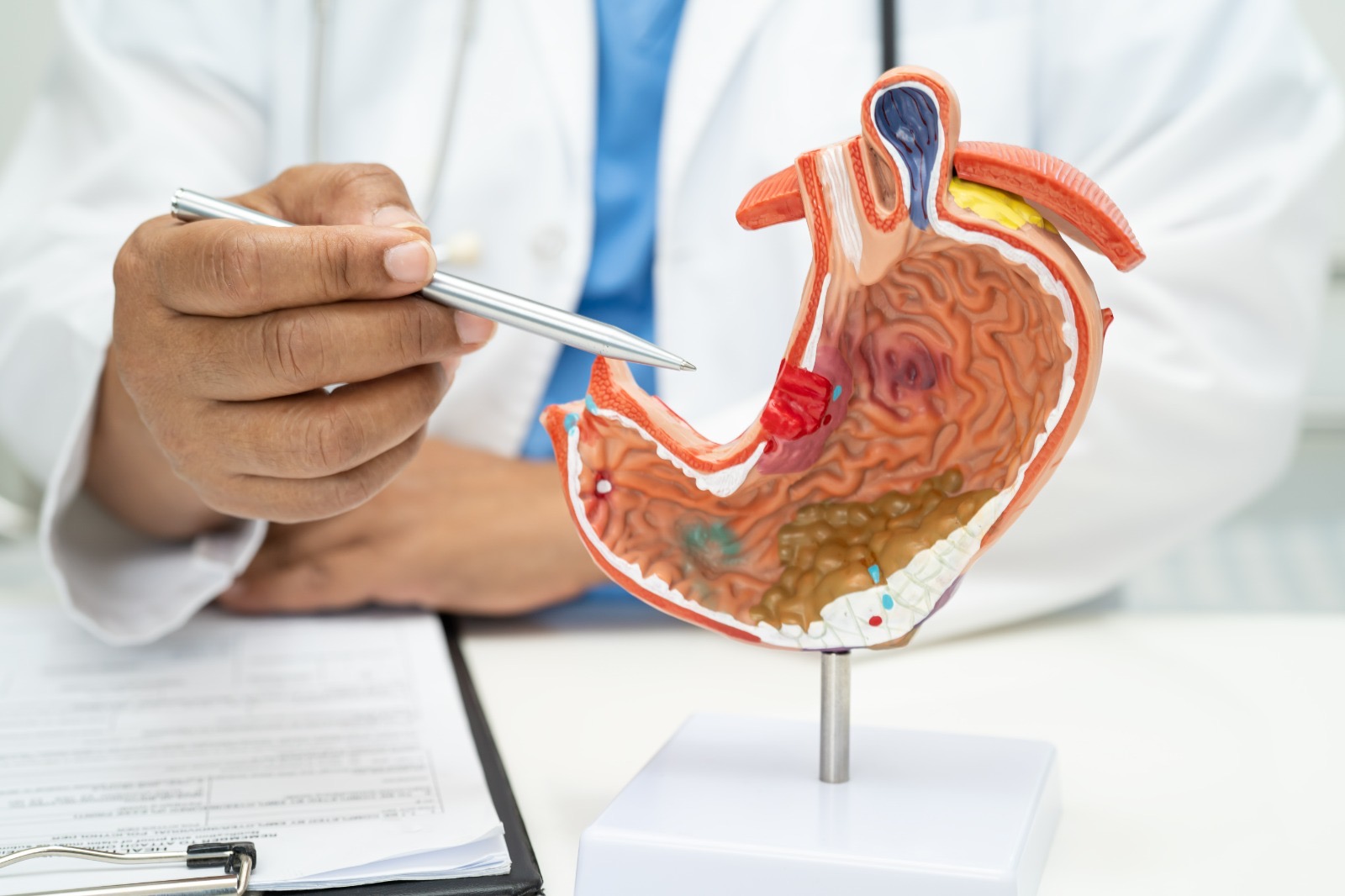 Prevenir el cáncer de páncreas es posible con hábitos saludables